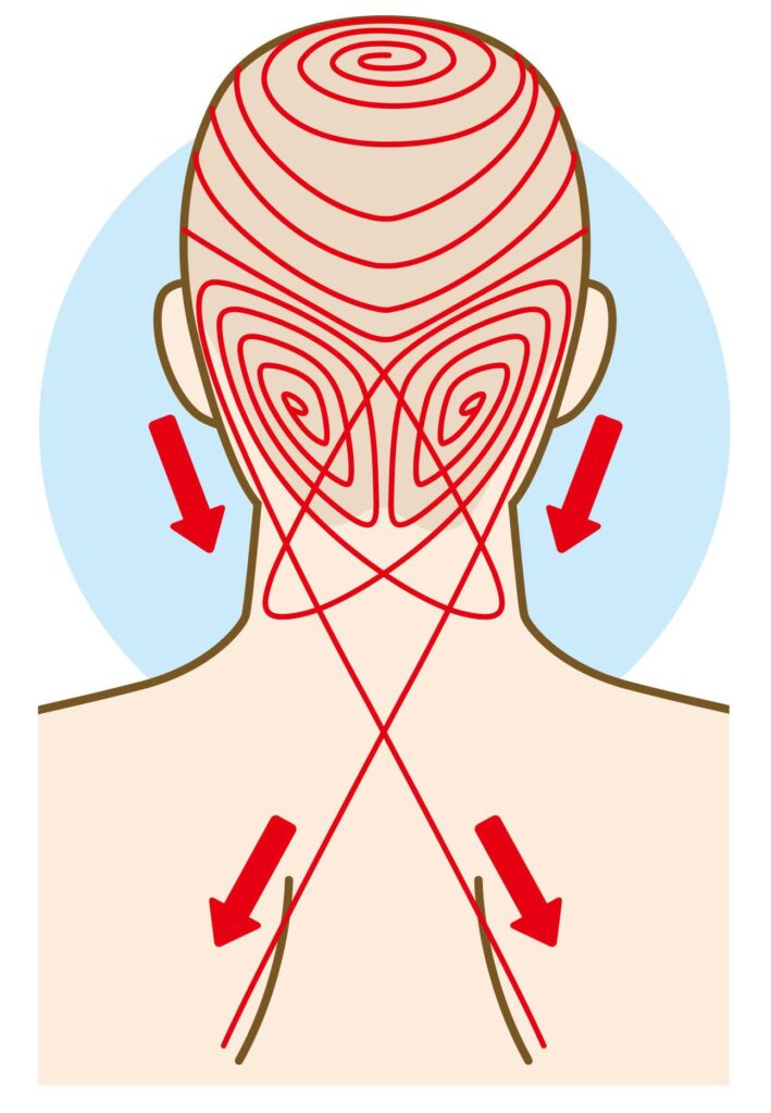 筋膜のねじれが伝線する経路イメージ