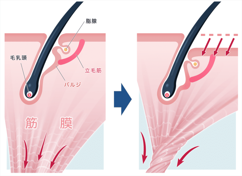 AGAのヘアサイクル（毛周期）